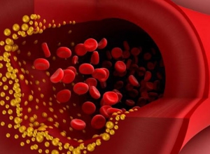 Cholesterol trong máu cao - Nguyên nhân và cách cân bằng 